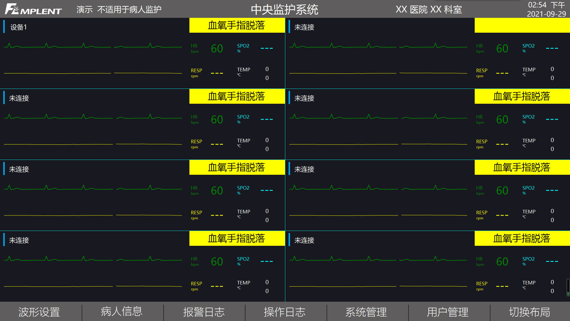 中央监护系统‍有哪些优点？