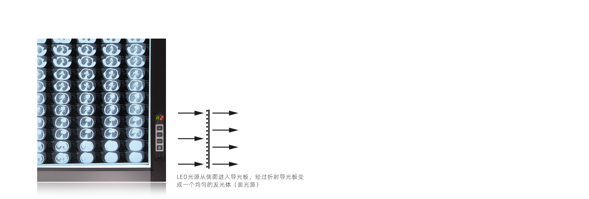 高清晰阅片体验
